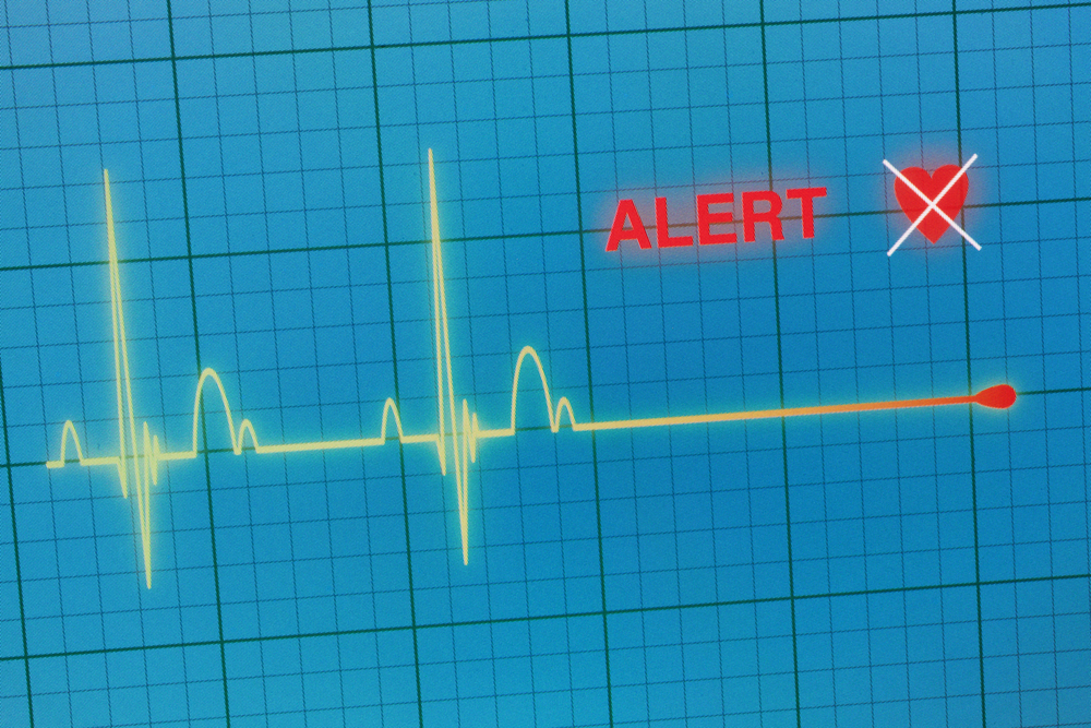 Flat line alert on a heart monitor.